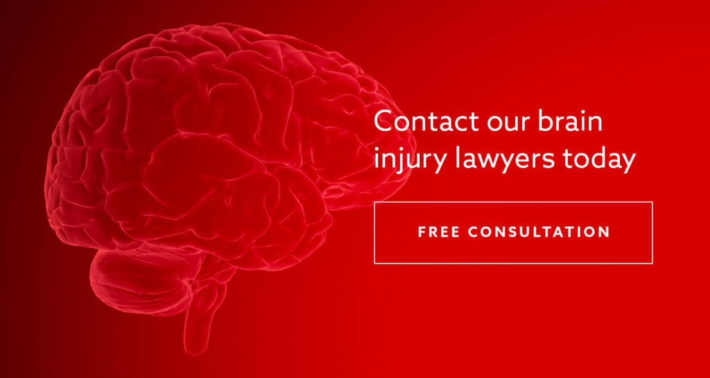 A CGI image of a brain with the text "Contact our brain injury lawyers today" superimposed