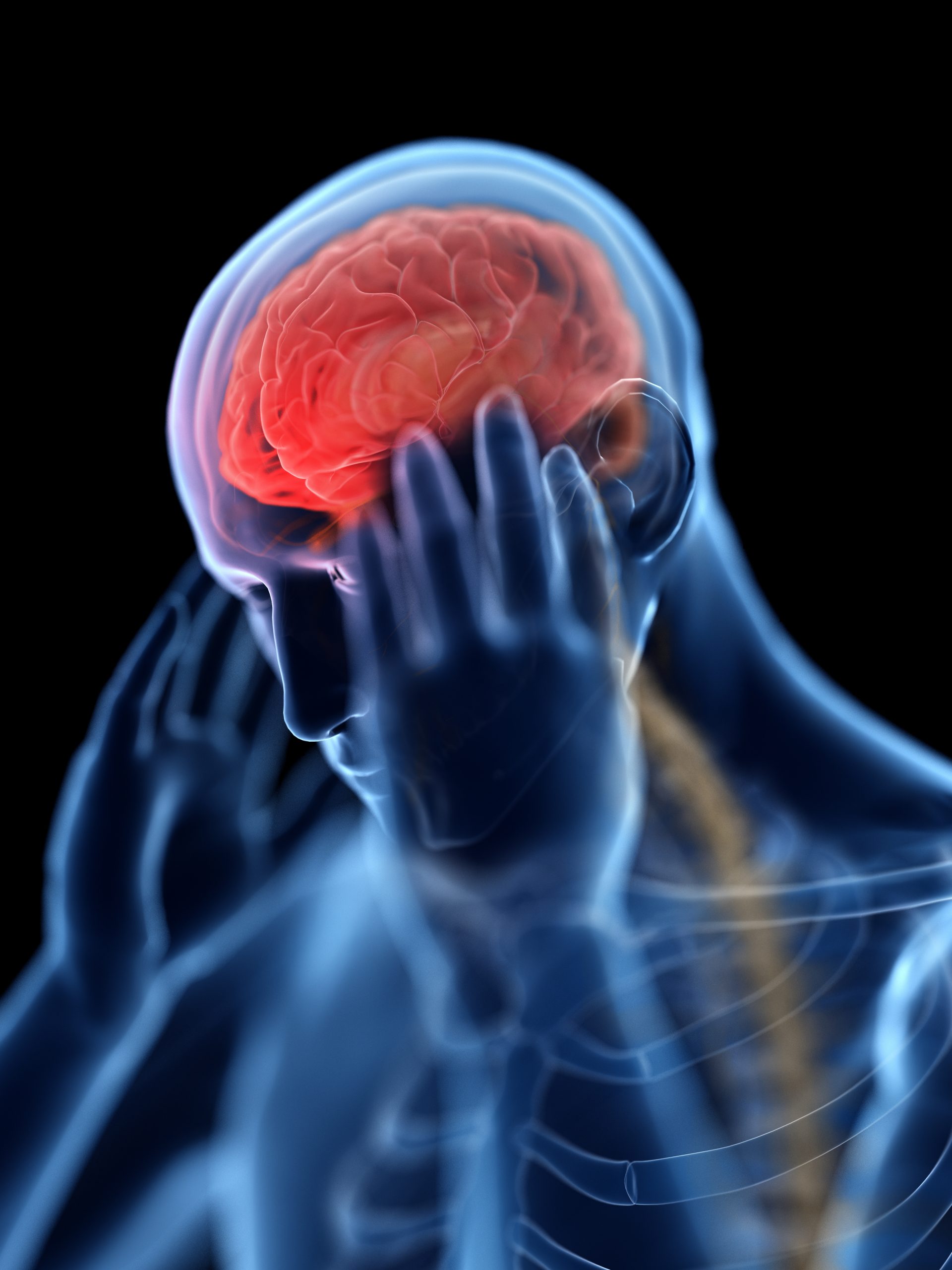 San Antonio's Traumatic Brain Injury Attorneys