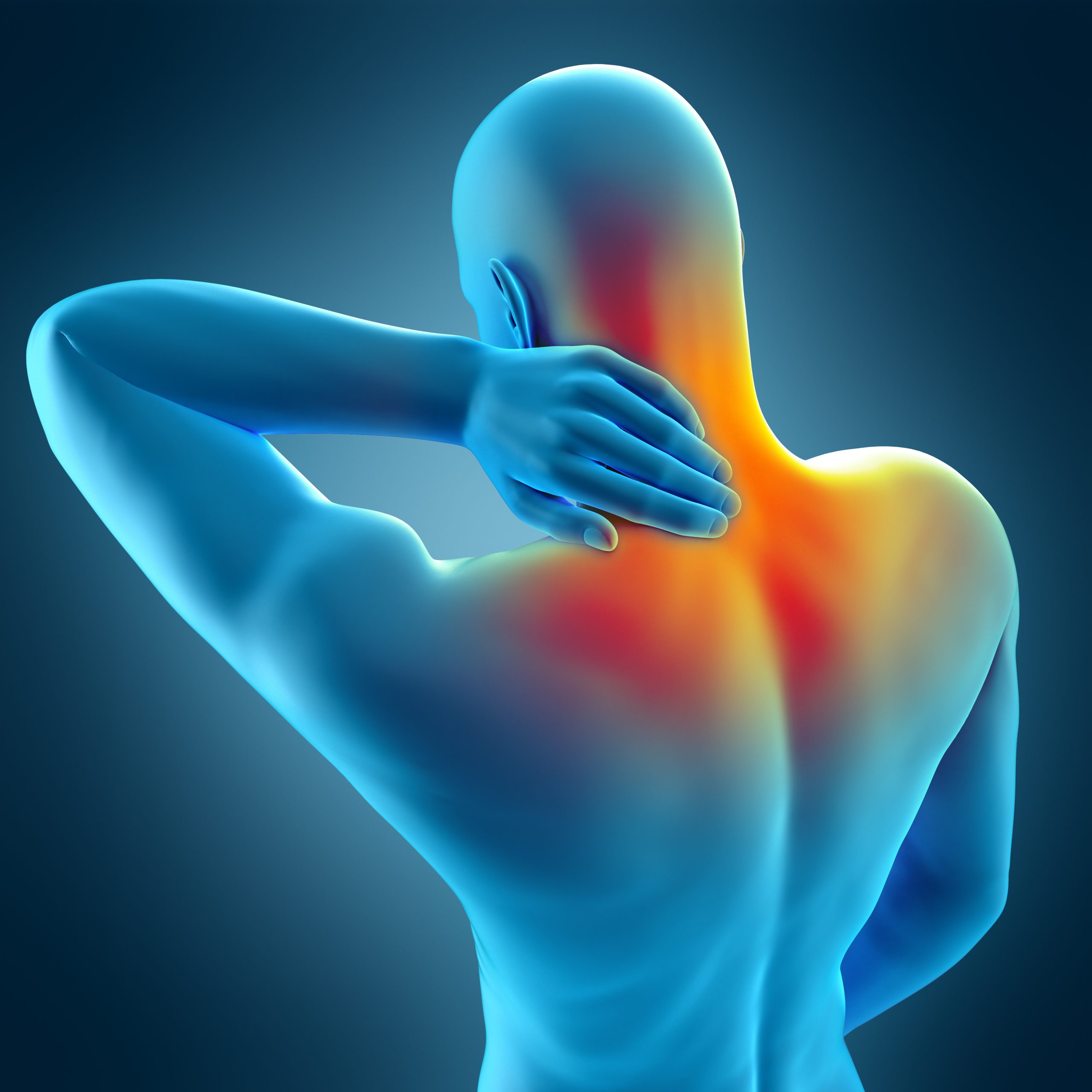 Neck Pain After an Accident