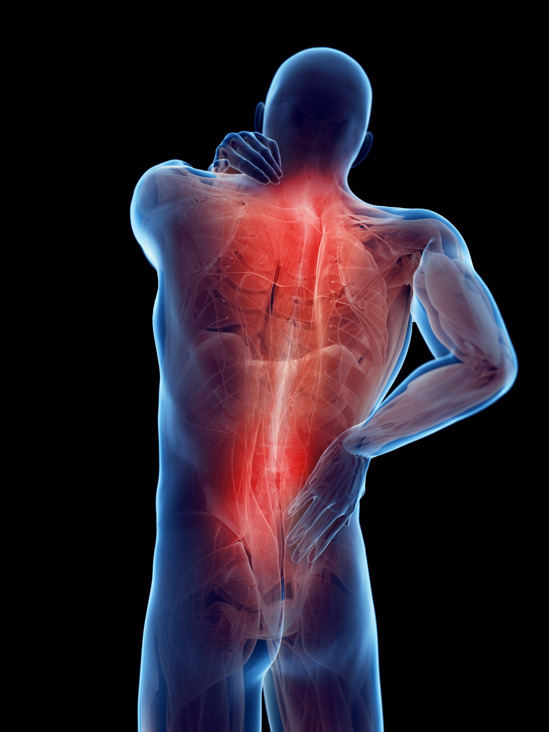 Spinal Cord Injuries in San Antonio