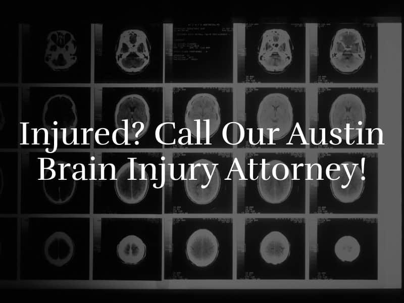 Austin Brain Injury Attorney