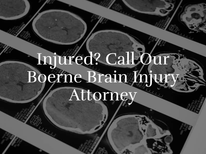 Boerne Brain Injury Attorney